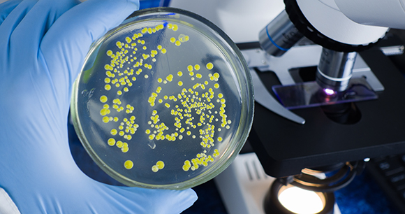 Bacterial culture in a petri dish, an example of a 2D cell culture.